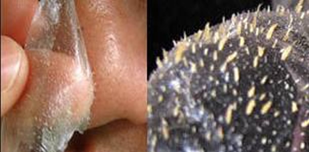 Creme: Limpeza do Rosto – limão e iogurte