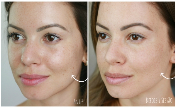 Detox facial para ter rosto de bebê ao acordar