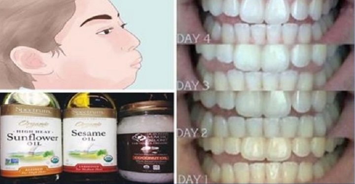 Como este óleo pode clarear seus dentes e deixar as gengivas muito mais saudáveis em minutos