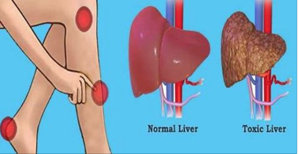 48 horas de detox no fim de semana: para você eliminar as toxinas e gorduras do seu corpo