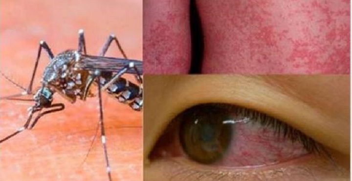 Dengue, zika, chicungunha Receitais naturais