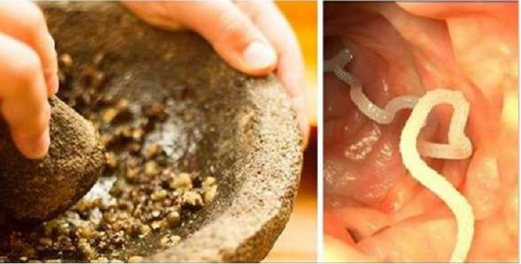 Receitas naturais para Eliminar vermes e ameba