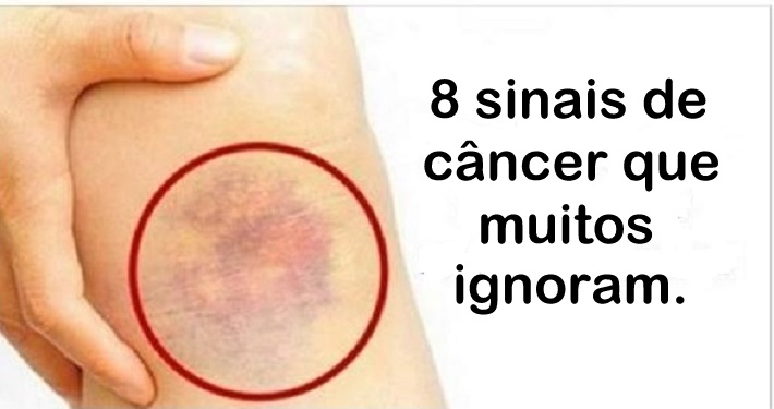 8 sinais de câncer que muitos ignoram