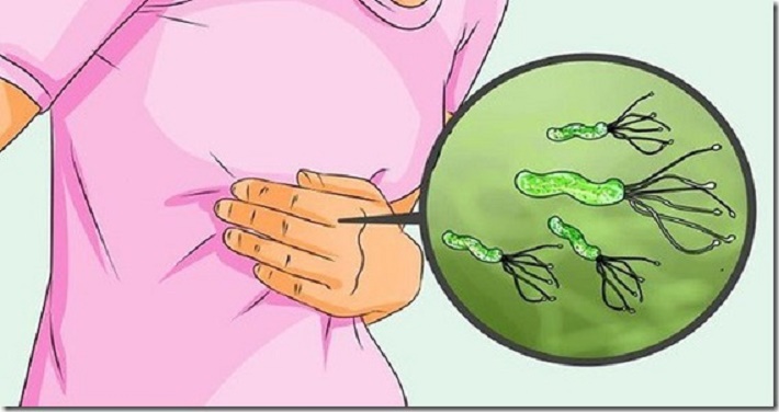 Melhores tratamentos naturais para a bactéria Helicobacter pylori