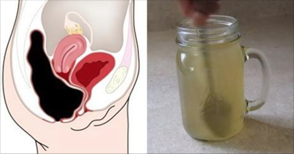 Esta simples bebida vai retirar quilos de toxinas do seu intestino
