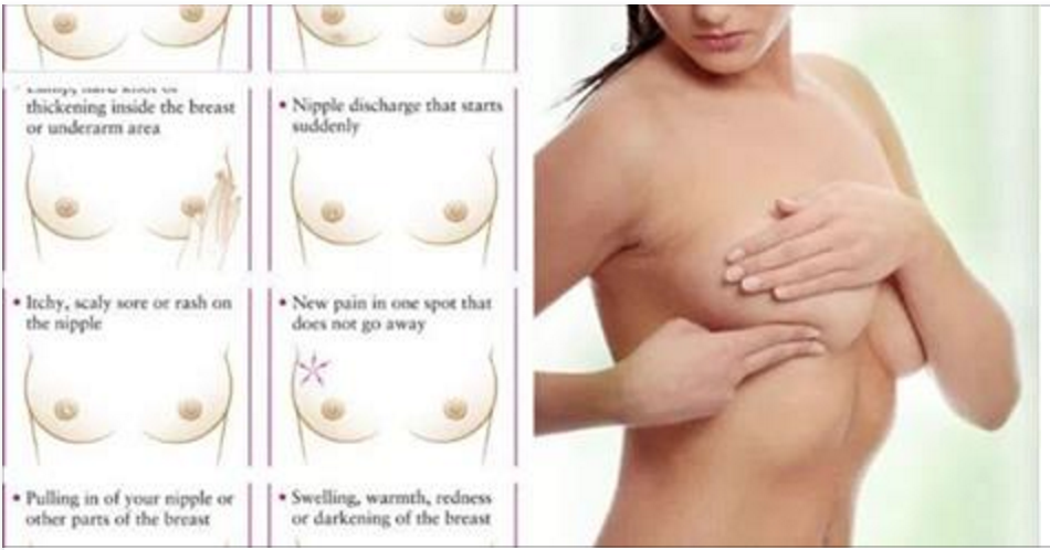 Estes são os sinais de câncer de mama que você não deve ignorar (e quais alimentos vão proteger você contra a doença)