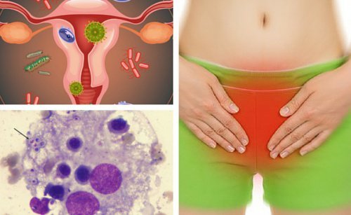 6 dicas para combater uma infecção vaginal