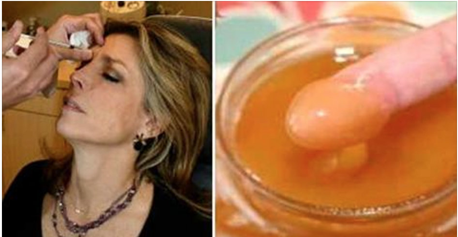 Com estes ingredientes, esqueça o botox esta máscara vai eliminar as rugas e rejuvenescer seu rosto! Com estes ingredientes, esqueça o botox esta máscara vai eliminar as rugas e rejuvenescer seu rosto!