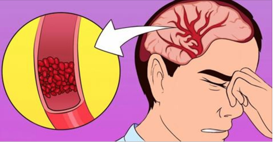 Se você tem dor de cabeça frequentemente, baixa energia e insônia, seu problema pode ser a carência destas 2 vitaminas