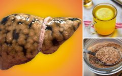 5 chás naturais que ajudam a tratar o fígado gorduroso