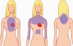 5 Sintomas de infarto feminino e como evitar o problema