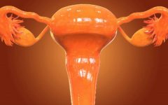 10 principais sintomas de cistos no ovário e como eliminá-los com remédios caseiros