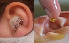 Estes são os melhores remédios caseiros para dor de ouvido