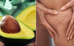 Celulite: como combatê-la com caroço de abacate