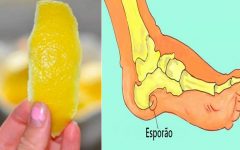 Use casca de limão e livre-se da dor de esporão do calcanhar