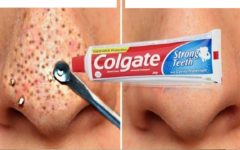 Como Remover Cravo do Nariz Com Creme Dental