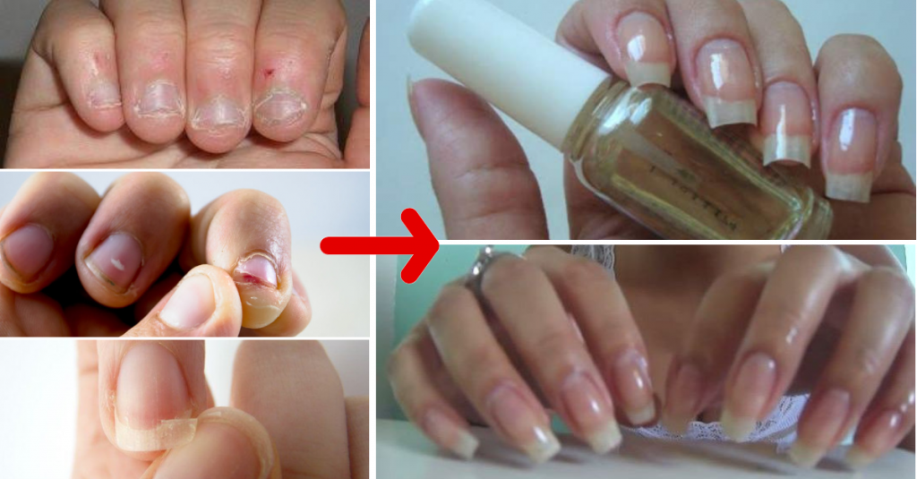 Como fazer as unhas crescerem mais rápido