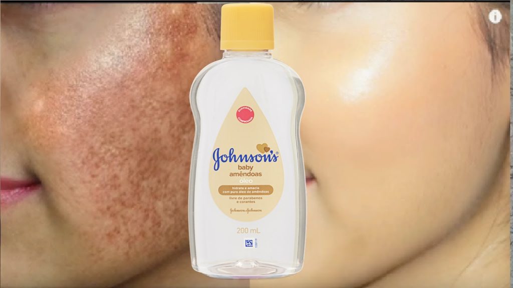 Como remover Manchas no Rosto, Rugas e Melasmas com Óleo Johnson