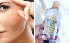 Como remover manchas e melasmas da pele com óleo de bebê