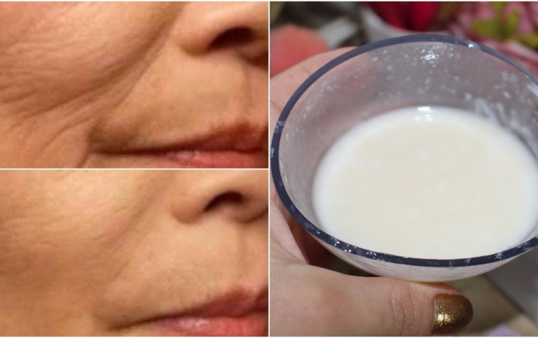 Receita Caseira Rugas e Manchas
