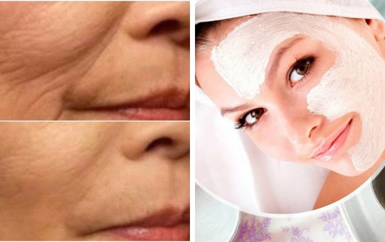 Receita Caseira Para Remover Manchas, Rugas e melasma em pouco tempo