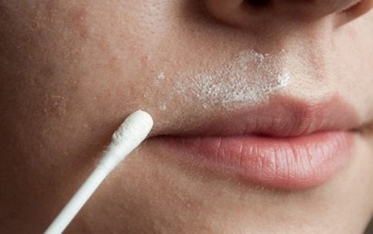 Receita Caseira Para Remover Pelos Faciais em 5 Minutos é 100% natural e eficaz