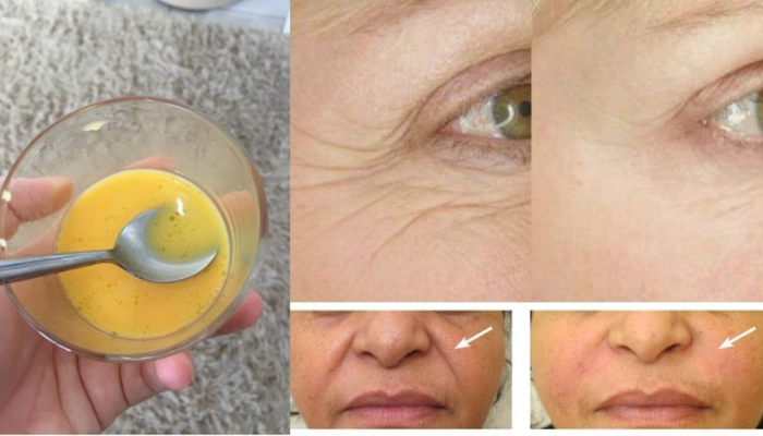 Botox caseiro de maisena; pele macia e rejuvenescida