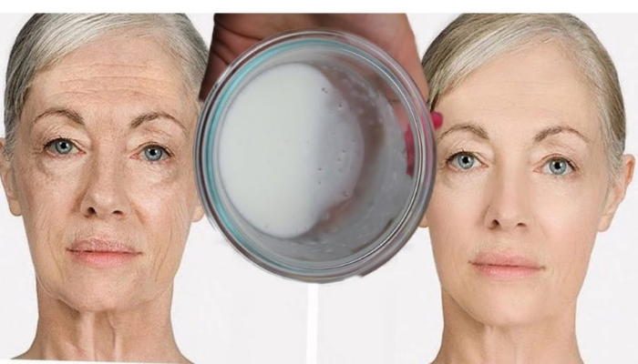 Elimine manchas de idade, espinhas e sinais de envelhecimento da pele com esta receita