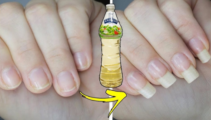 Receita caseira com vinagre para sua unha crescer Rápido – Use o que você tem em casa!