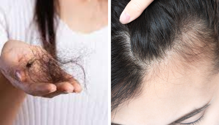Pare a queda de cabelo e faça-o crescer como nunca com esta receita com banana e cerveja preta