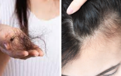 Remédios caseiros que fazem o cabelo parar de cair e crescer 2X mais rápido