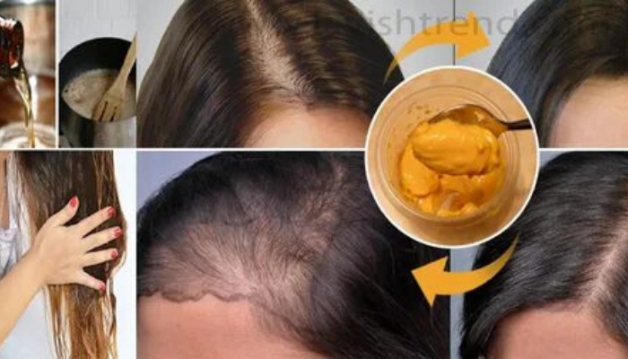 Elimine a queda de cabelo e estimule um rápido crescimento com estas 2 receitas caseiras