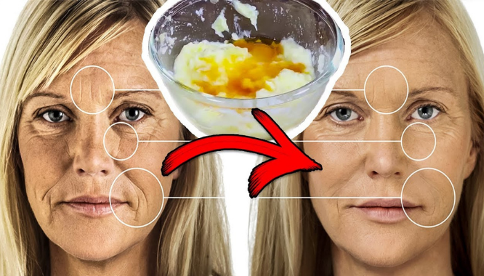 Como eliminar rugas com ingredientes que você tem em casa