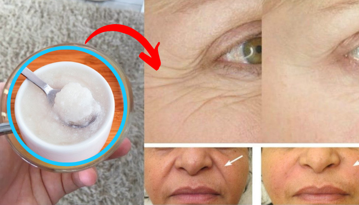 Como tirar manchas do rosto: 5 dicas caseiras infalíveis