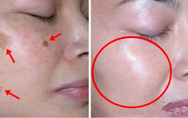 Creme caseiro natural para clarear a pele