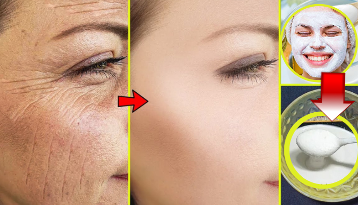 Creme caseiro para Para Remover manchas escuras no rosto, Rugas e melasma em pouco tempo