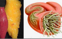 Como acabar com vermes e depósitos de gordura do corpo com receitas naturais