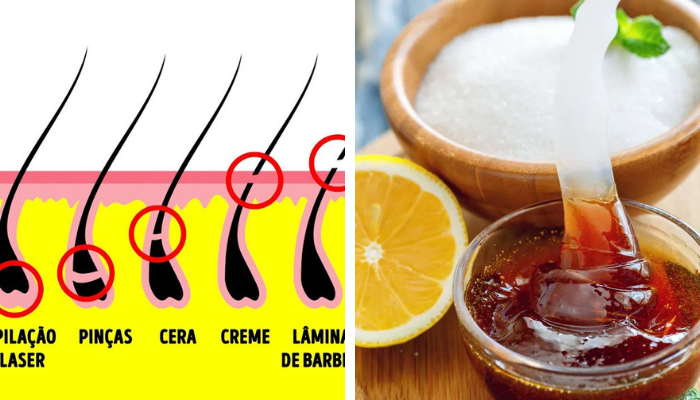 Receitas caseiras: Depilação definitiva caseira