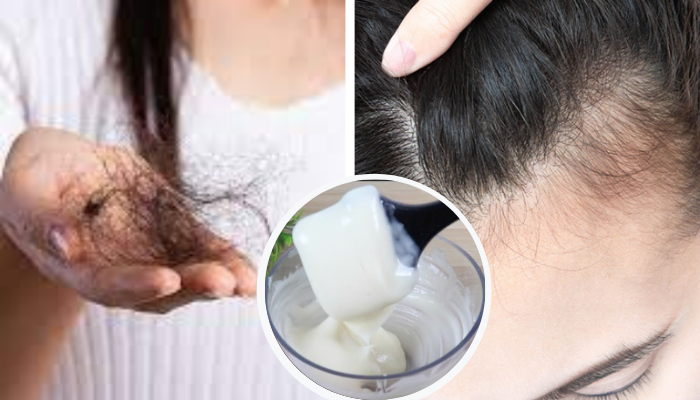 Cabelo para de cair e cresce 2X mais rápido com esta receita
