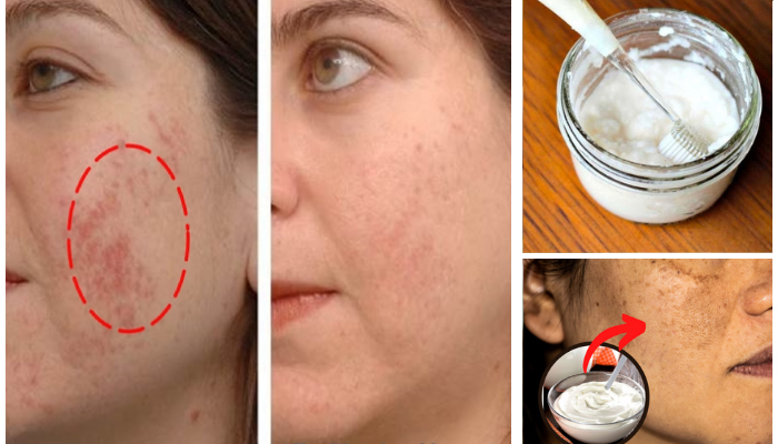 Receita Para Remover manchas escuras e rugas