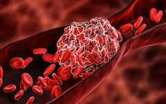 10 anticoagulantes naturais que ajudam a evitar doenças como AVC e infarto