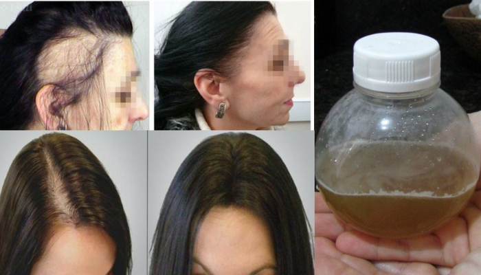 Receitas para queda de cabelo crescimento capilar rápido