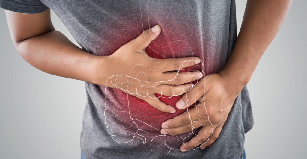 Câncer de intestino: 10 sintomas que não devem ser ignorados