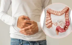 10 Sintomas de Câncer de Intestino: Causas, Prevenção e Tratamento